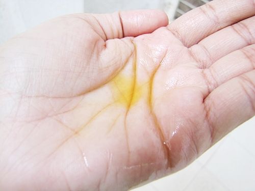 hair photo:chemotherapy hair loss prevention 
